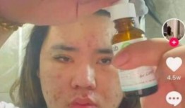 吃瓜网红打架事件视频,视频曝光惊人一幕