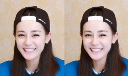 牙医爆料明星整牙视频,牙医亲述整牙全过程